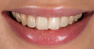 Before - Ringway Dental