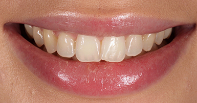 Before - Ringway Dental
