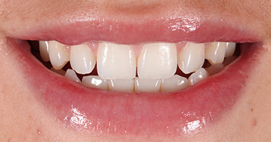 Before - Ringway Dental