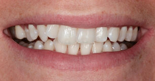 Before - Ringway Dental