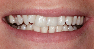 Before - Ringway Dental