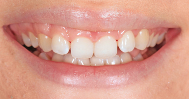 Before - Ringway Dental