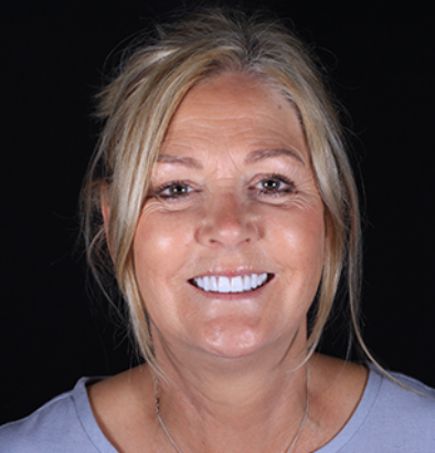 Face - Ringway Dental