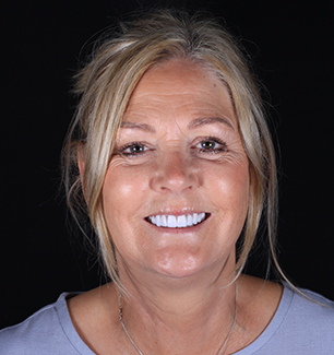 Face - Ringway Dental