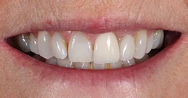 Before - Ringway Dental