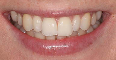 Before - Ringway Dental