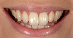 Before - Ringway Dental