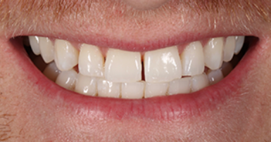 Before - Ringway Dental