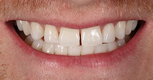 Before - Ringway Dental