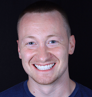 Face - Ringway Dental