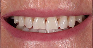 Before - Ringway Dental