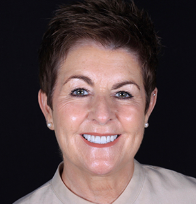 Face - Ringway Dental