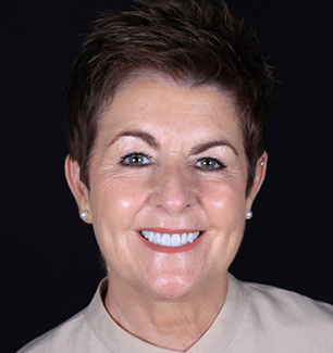 Face - Ringway Dental