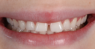 Before - Ringway Dental