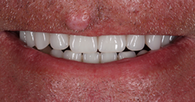 After - Ringway Dental