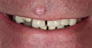 Before - Ringway Dental