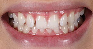Before - Ringway Dental