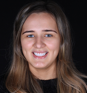 Face - Ringway Dental