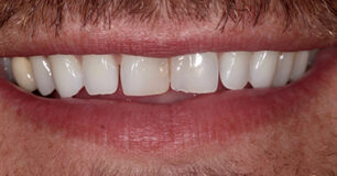 Before - Ringway Dental