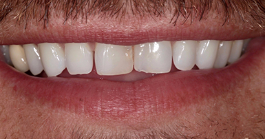 Before - Ringway Dental