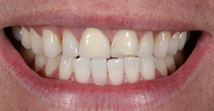 Before - Ringway Dental