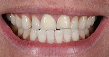 Before - Ringway Dental