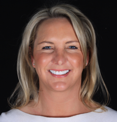 Face - Ringway Dental