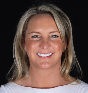 Face - Ringway Dental