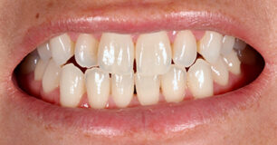 Before - Ringway Dental