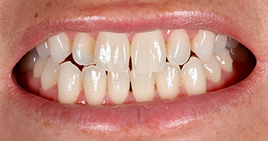 Before - Ringway Dental