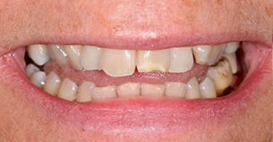 Before - Ringway Dental