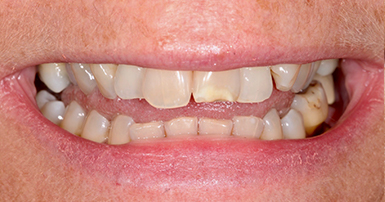 Before - Ringway Dental