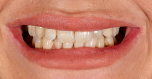Before - Ringway Dental