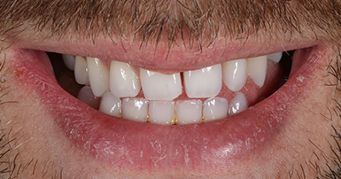 Before - Ringway Dental