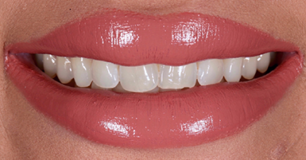 Before - Ringway Dental