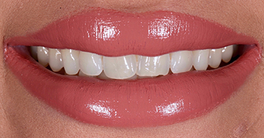 Before - Ringway Dental