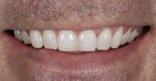 Before - Ringway Dental