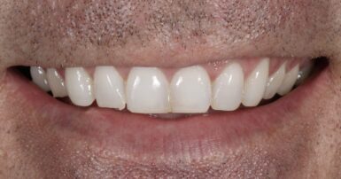 Before - Ringway Dental