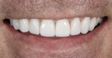 After - Ringway Dental