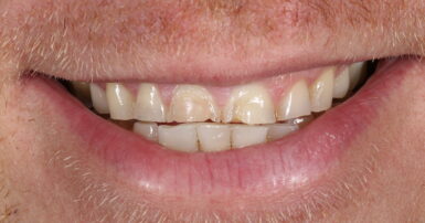 Before - Ringway Dental