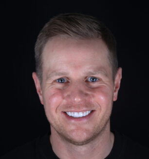 Face - Ringway Dental