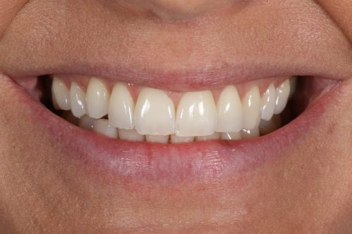ringwaydental