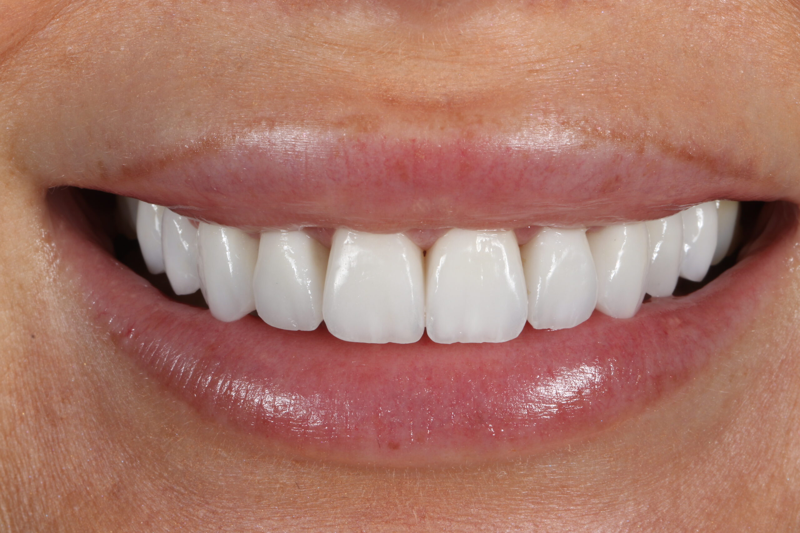 ringwaydental