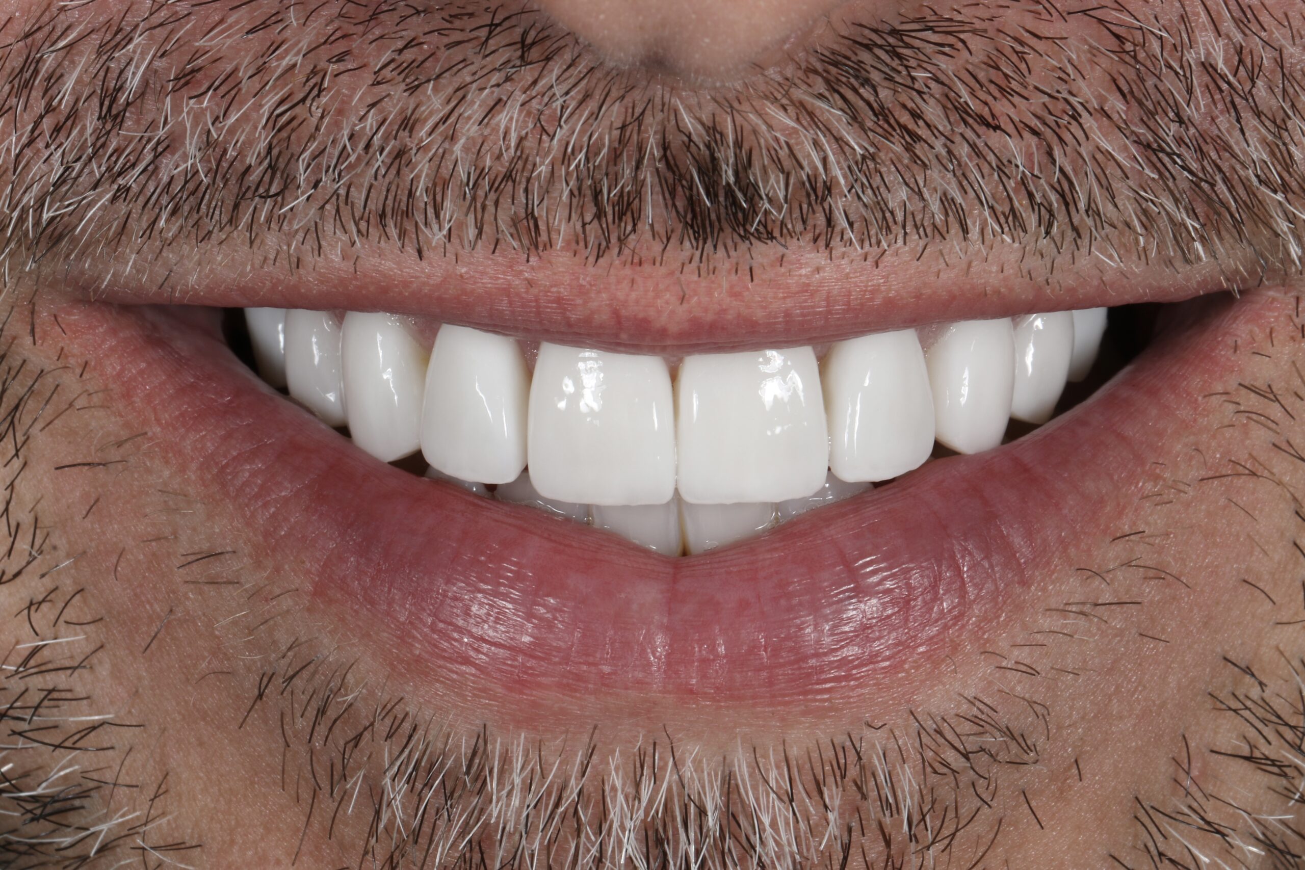 ringwaydental