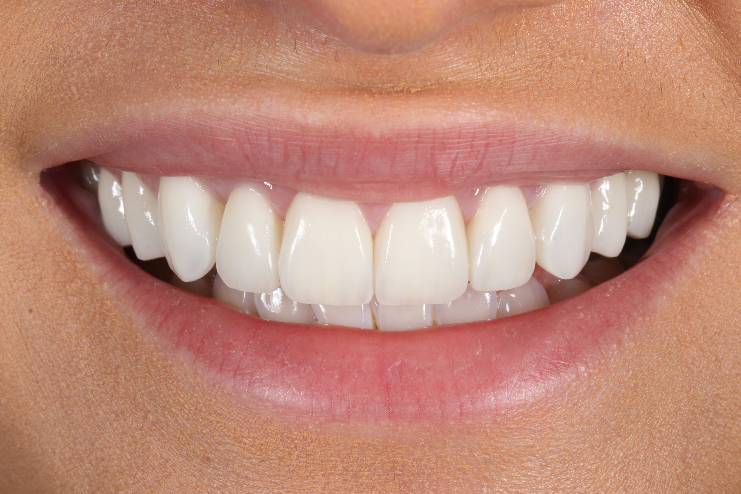 ringwaydental