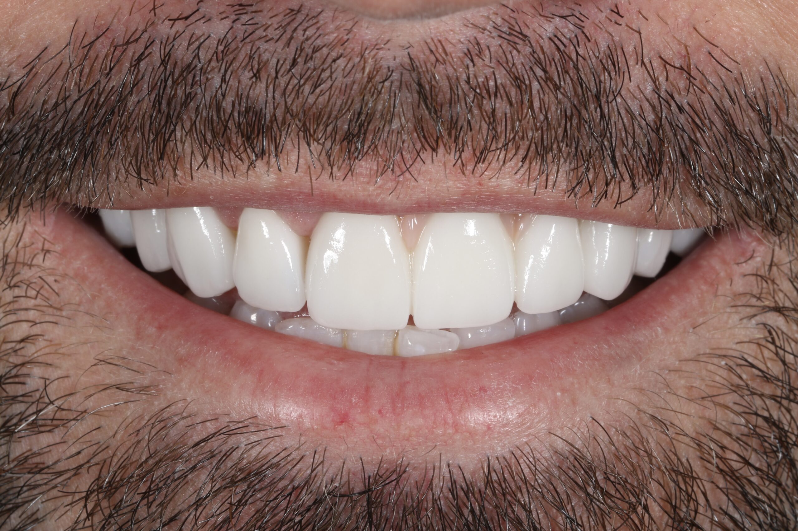 ringwaydental