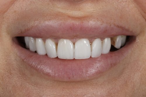ringwaydental