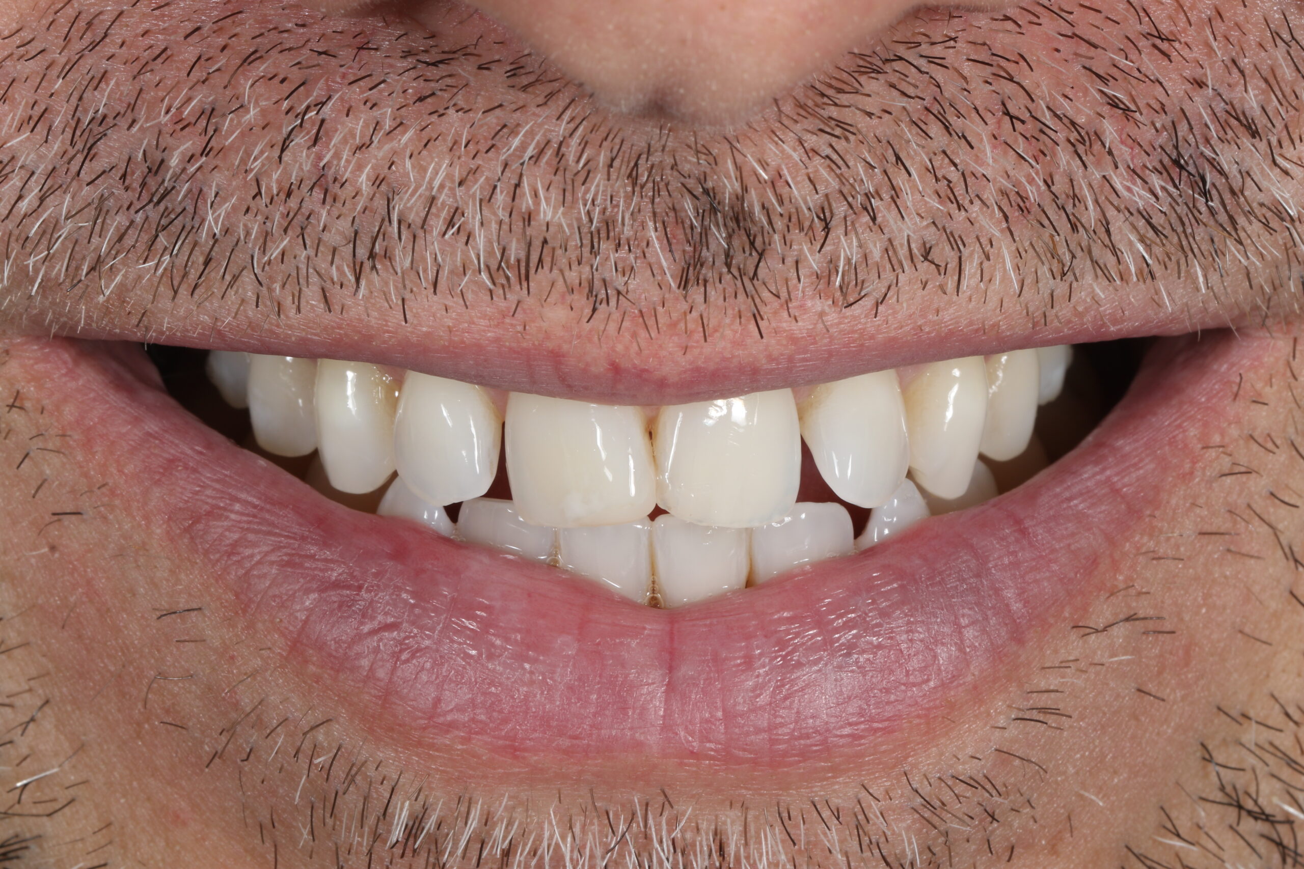 ringwaydental