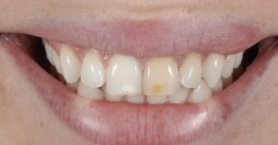 Before - Ringway Dental