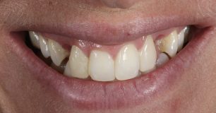 Before - Ringway Dental